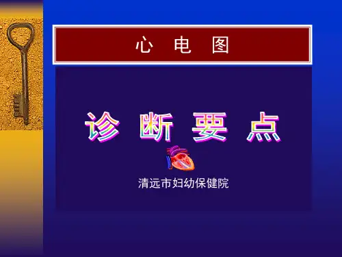 常见心电图诊断要点