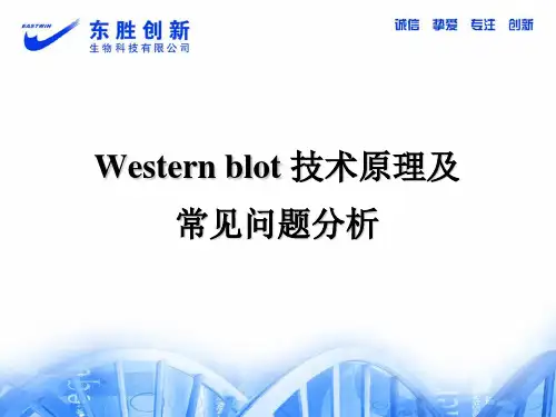 Western Blot 技术原理及常见问题分析2
