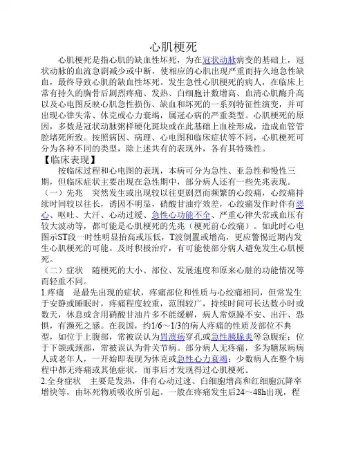 急性心肌梗死 3