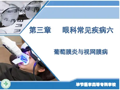 五官科学-第三章眼科常见疾病6虹膜睫状体炎与视网膜疾病