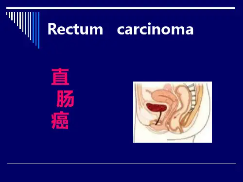 直肠癌课件