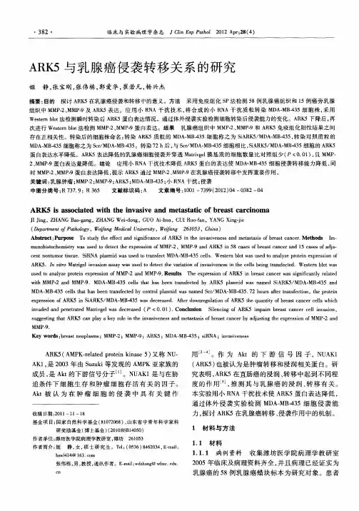 ARK5与乳腺癌侵袭转移关系的研究