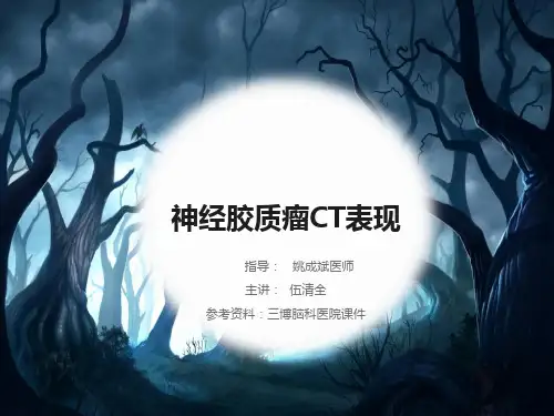 神经胶质瘤