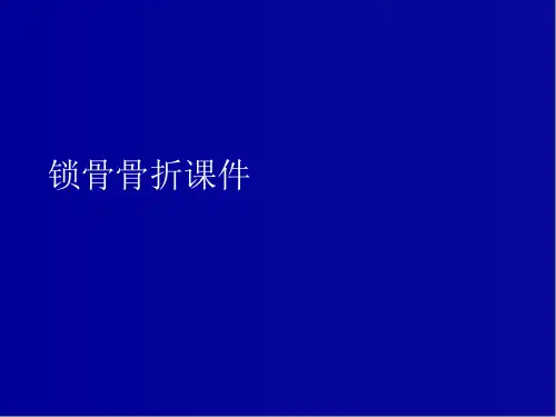 锁骨骨折课件PPT课件