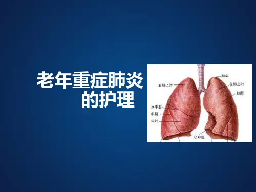 重症肺炎的护理  ppt课件