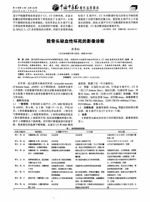 股骨头缺血性坏死的影像诊断 2