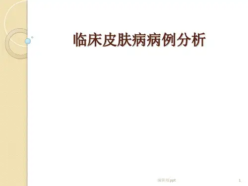 临床皮肤病病例分析