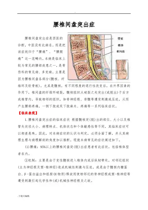 腰椎间盘突出症 3