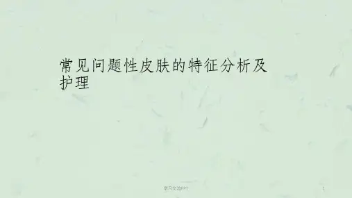 问题性皮肤的特征分析及护理(痤疮)ppt课件