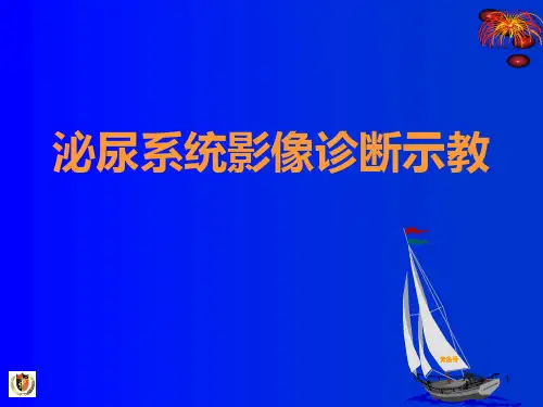 【影像诊断课件】腹部实质脏器影像诊断示教