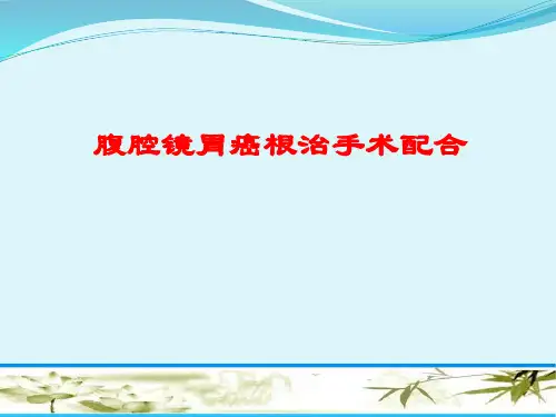 腹腔镜胃癌根治术