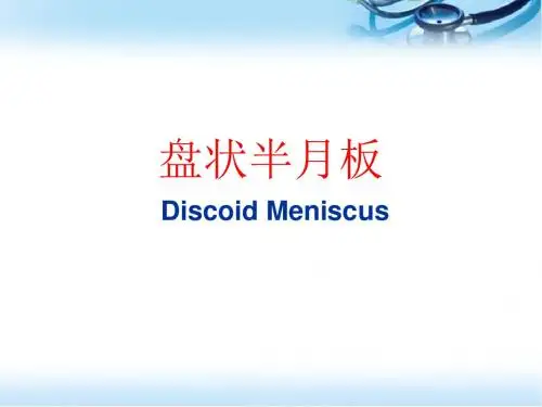 (医学课件)盘状半月板
