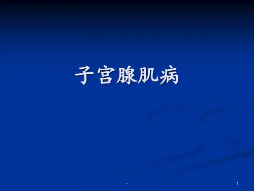子宫腺肌症ppt课件