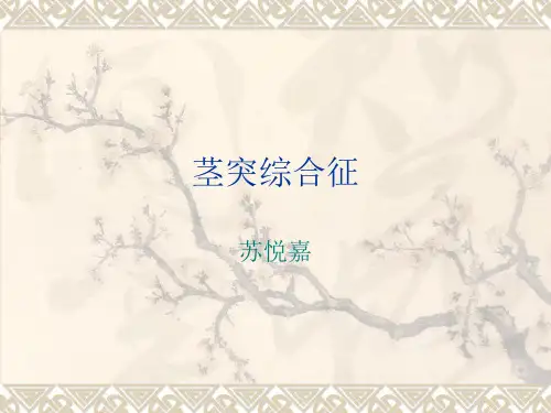 茎突综合征