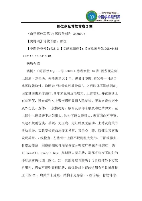 部位少见骨软骨瘤2例