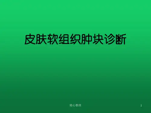 演示模板皮肤软组织肿块超声诊断.ppt