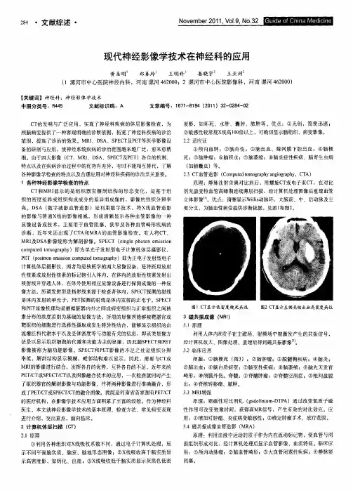 现代神经影像学技术在神经科的应用