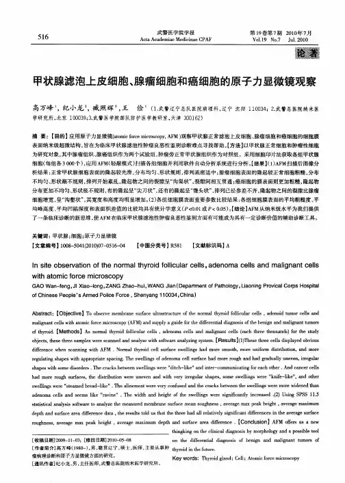 甲状腺滤泡上皮细胞、腺瘤细胞和癌细胞的原子力显微镜观察