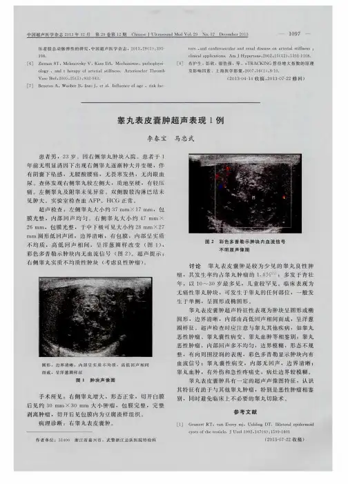 睾丸表皮囊肿超声表现1例