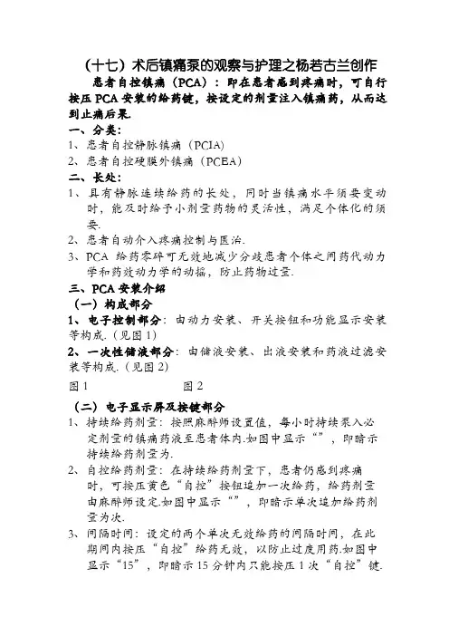 镇痛泵使用