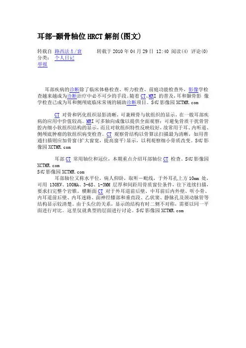 耳部-颞骨轴位HRCT解剖(图文)