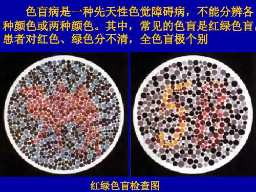 性别决定