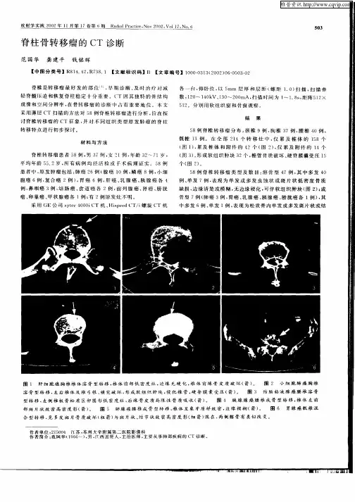 脊柱骨转移瘤的CT诊断