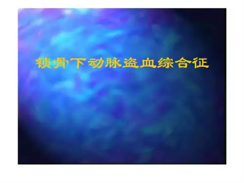 锁骨下动脉盗血综合征(1)