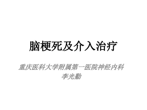 脑梗死及介入治疗