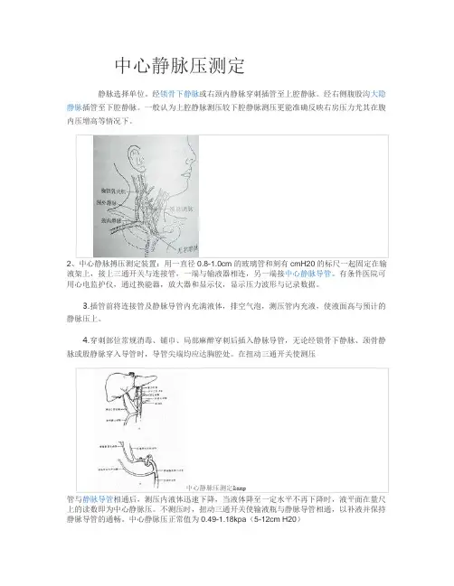 中心静脉压 3