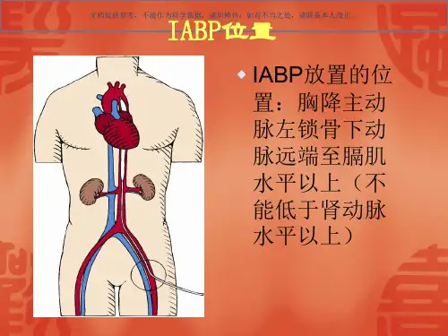 IABP的护理要点课件