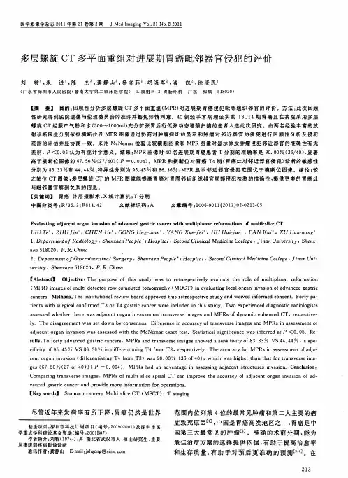 多层螺旋CT多平面重组对进展期胃癌毗邻器官侵犯的评价