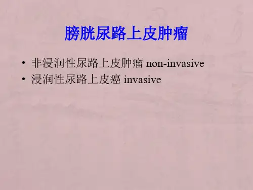 膀胱尿路上皮肿瘤的诊断和鉴别诊断