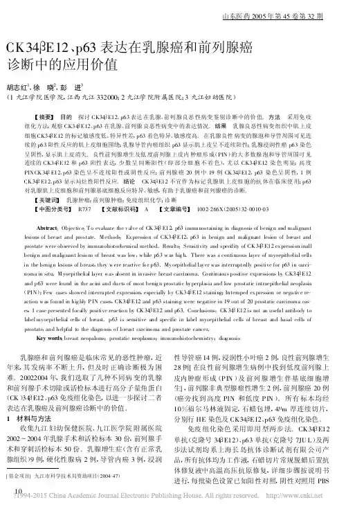 CK34_E12_p63表达在乳腺癌和前列腺癌诊断中的应用价值_胡志红