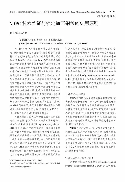 MIPO技术特征与锁定加压钢板的应用原则