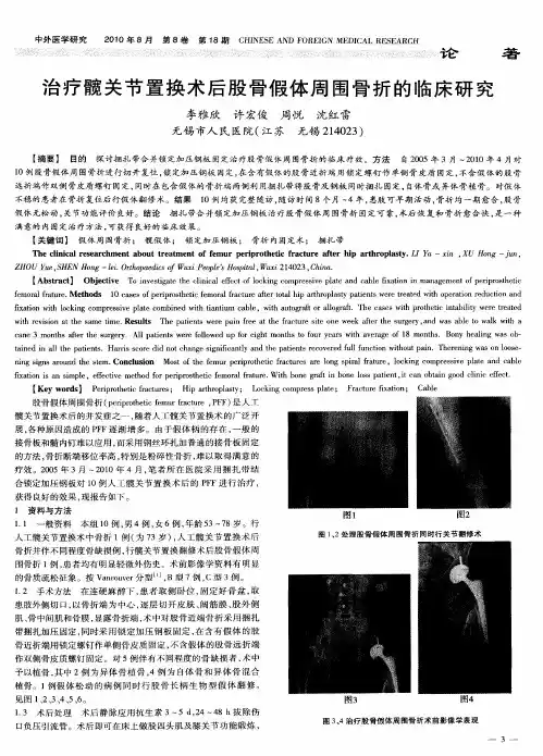 治疗髋关节置换术后股骨假体周围骨折的临床研究