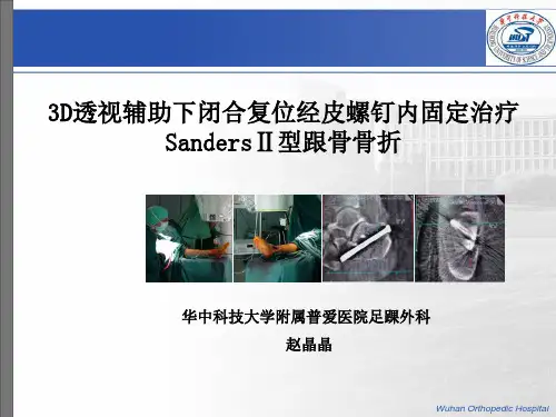 3D跟骨中文