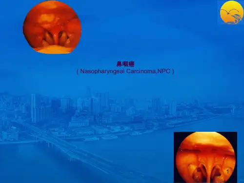 本科生鼻咽癌讲课幻灯(2013年)ppt课件