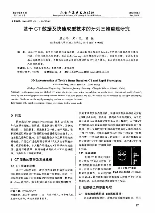 基于CT数据及快速成型技术的牙列三维重建研究