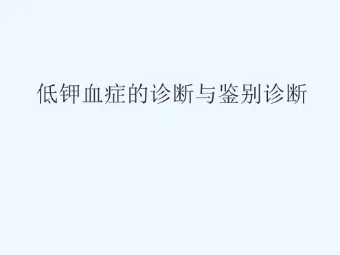 低钾血症诊断与鉴别诊断