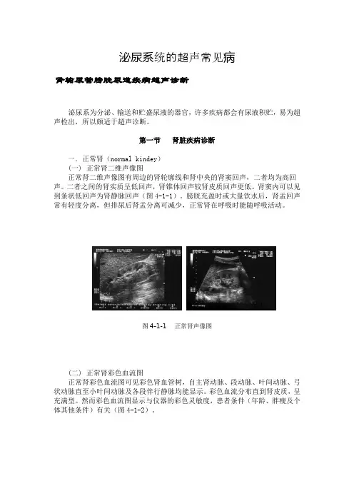泌尿系统的超声常见病汇总
