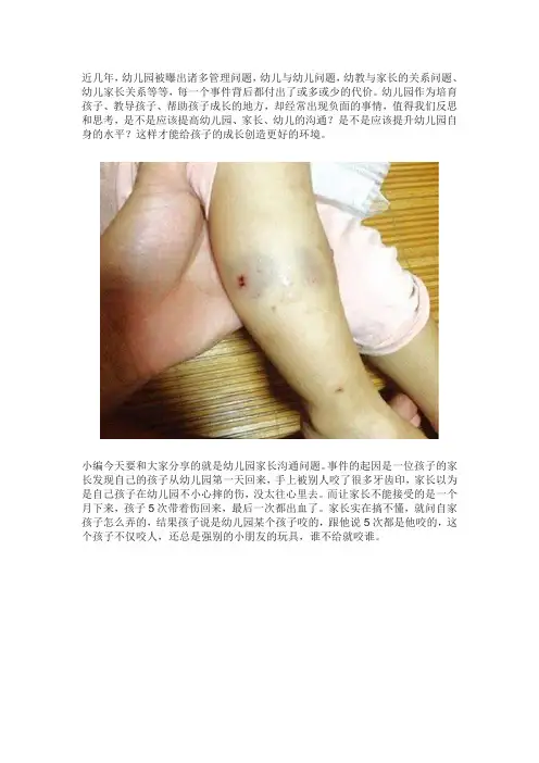 孩子在幼儿园被咬出血,在家长群质问,对方：小孩玩闹大人别插手