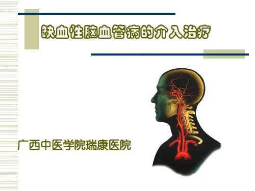 缺血性脑血管病的介入治疗 ppt课件