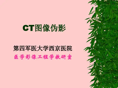 CT影像伪影及原因