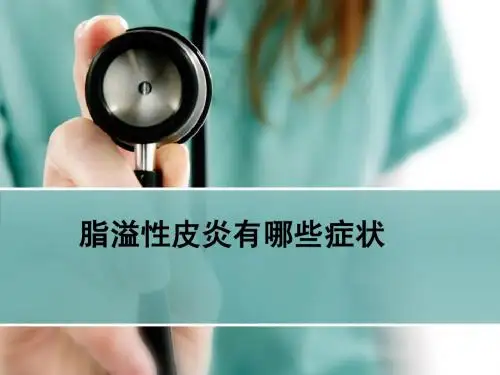 脂溢性皮炎有哪些症状