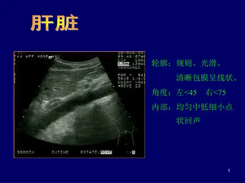 B超影像图谱PPT精选课件