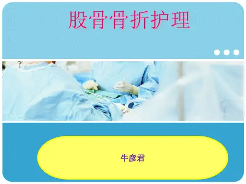 股骨骨折护理
