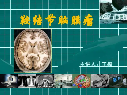 鞍结节脑膜瘤诊断及治疗