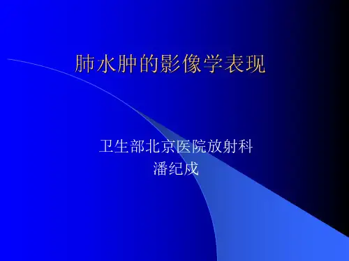 医学影像-肺水肿的影像学表现