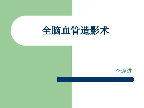 全脑血管造影术